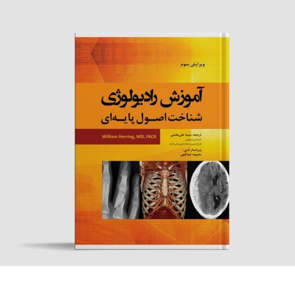 Price and Buy Learning Radiology: Recognizing the Basics (Farsi)_68fcadb404d39.jpeg Price and Buy Learning Radiology: Recognizing the Basics (Farsi)